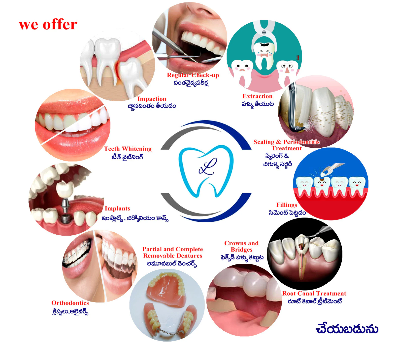 Piles and Fistula Treatment